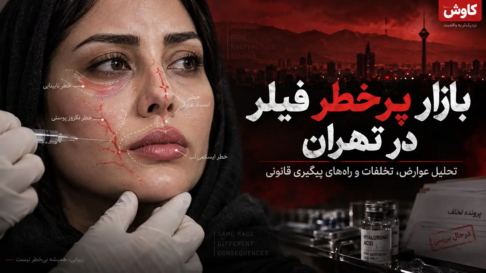بدترین کلینیک‌های تزریق فیلر در تهران - بررسی نظرات کاربران